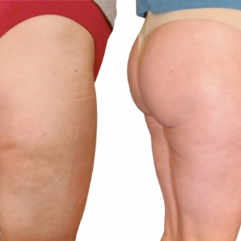 Glutes