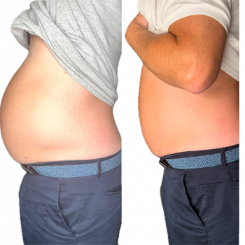 belly fat